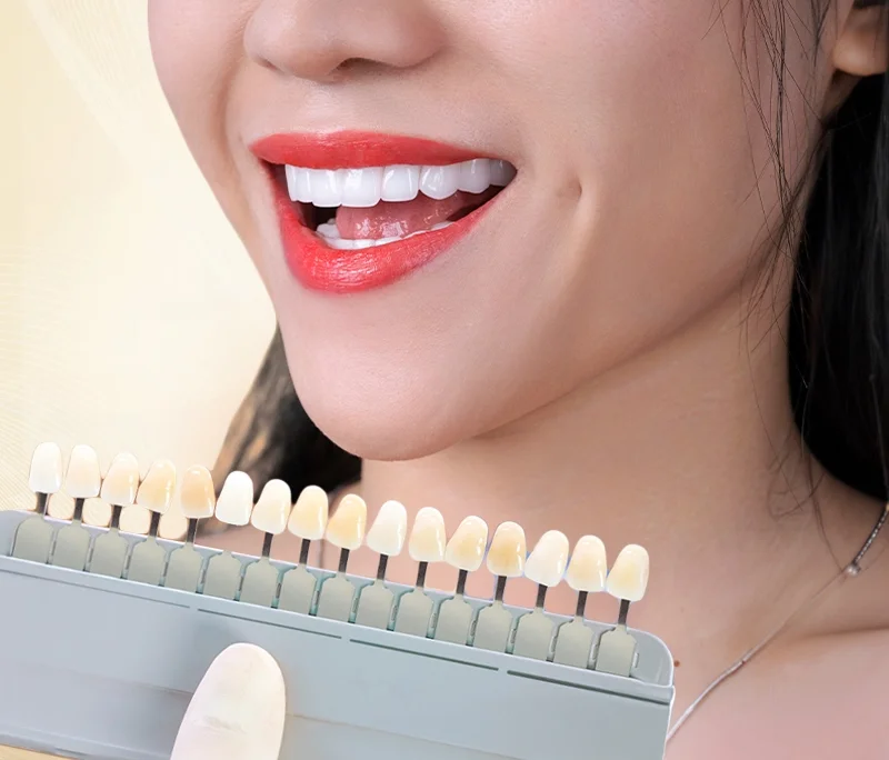 Răng sứ Lava Esthetic giá bao nhiêu? Cập nhật bảng giá 2025 & Đánh giá